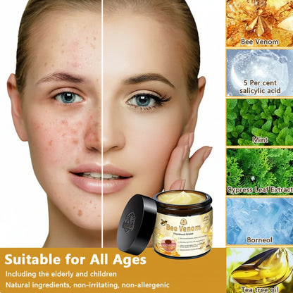 Bee Venom Treatment Cream – Deep Moisturizing & Firming Skin Care Cream | Bee Skin Elixir